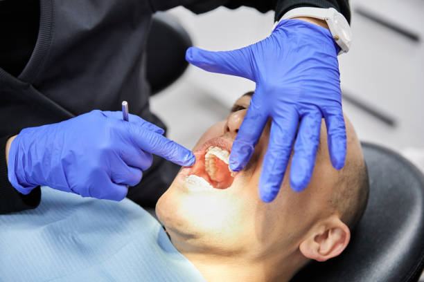 Best Emergency Denture Repair in Samoset, FL